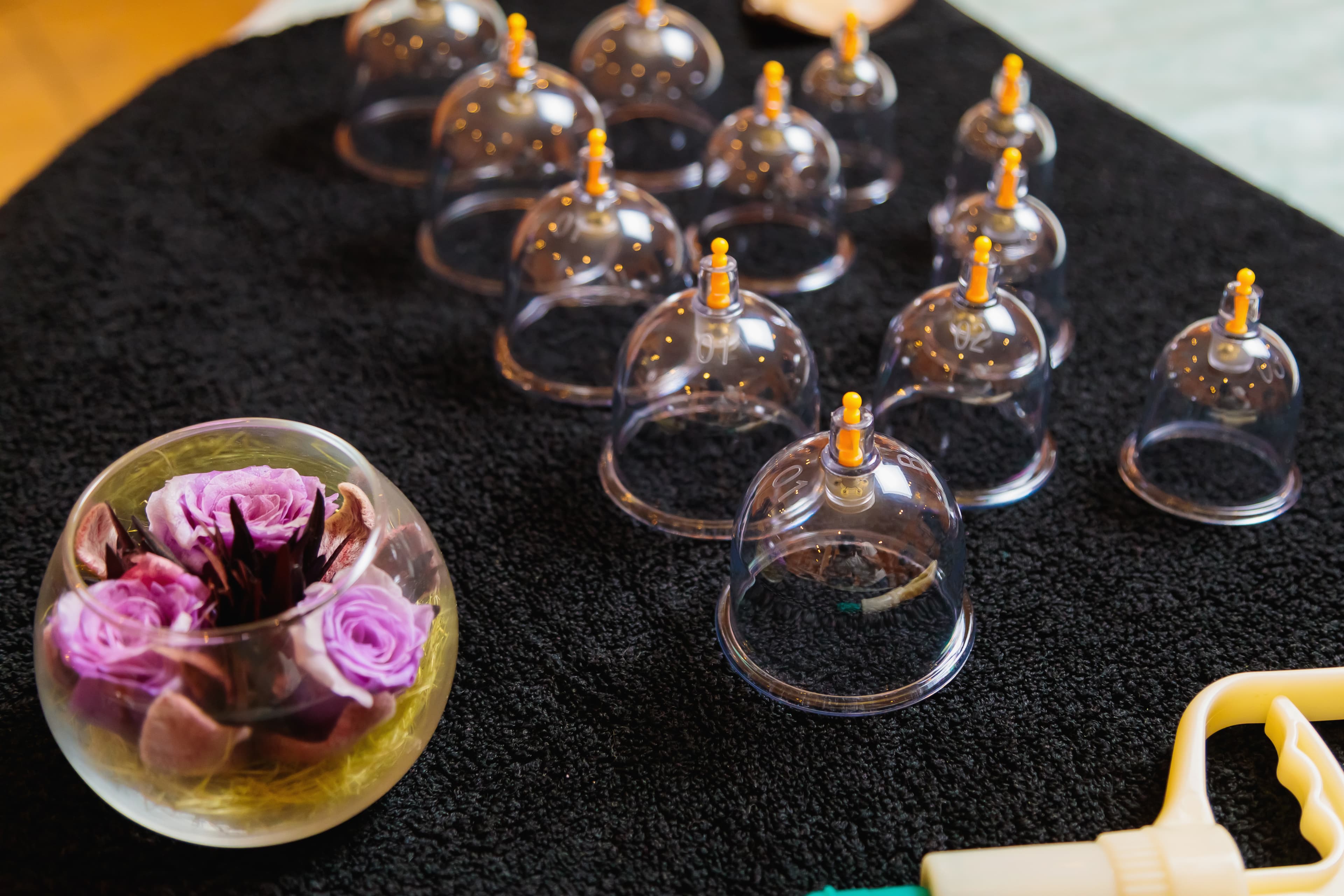 The Impact of Hijama (Cupping Therapy) on Blood Circulation and  Cholesterol