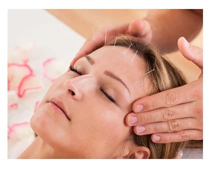 Introduction to Acupuncture