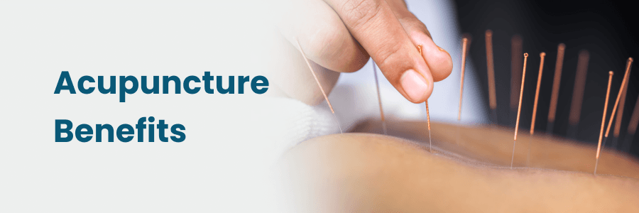 The Benefits of Acupuncture for Pain Management