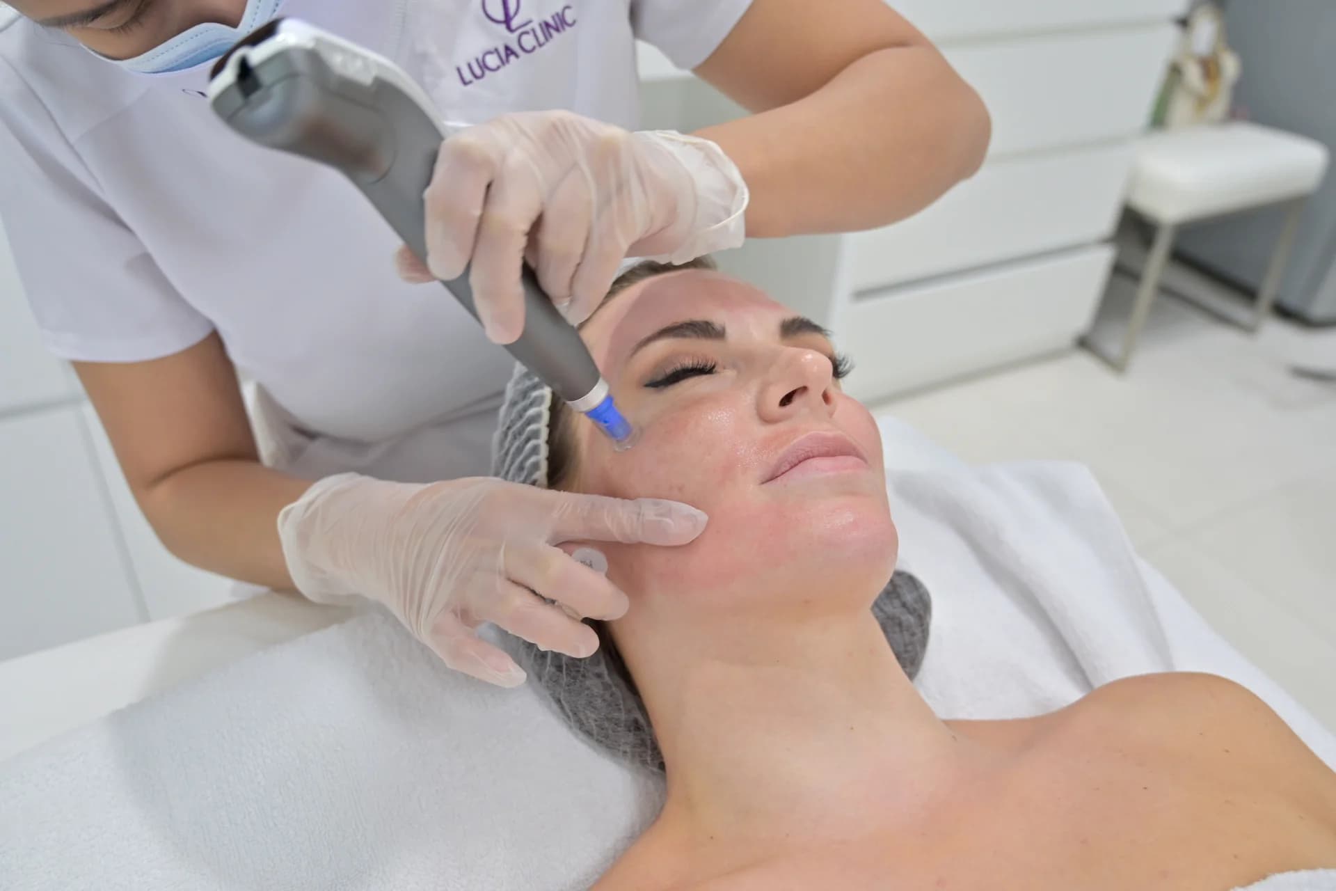Microneedling: How Tiny Needles Can Transform Your Skin