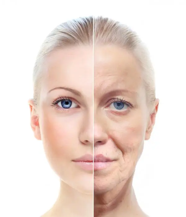 Wrinkles & Aging Signs